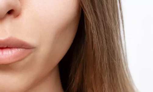 Hollow Cheeks
